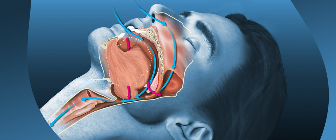 The Best Natural Remedies to Stop Snoring