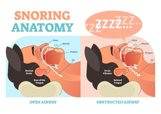 7 Common Myths About Snoring—Debunked!
