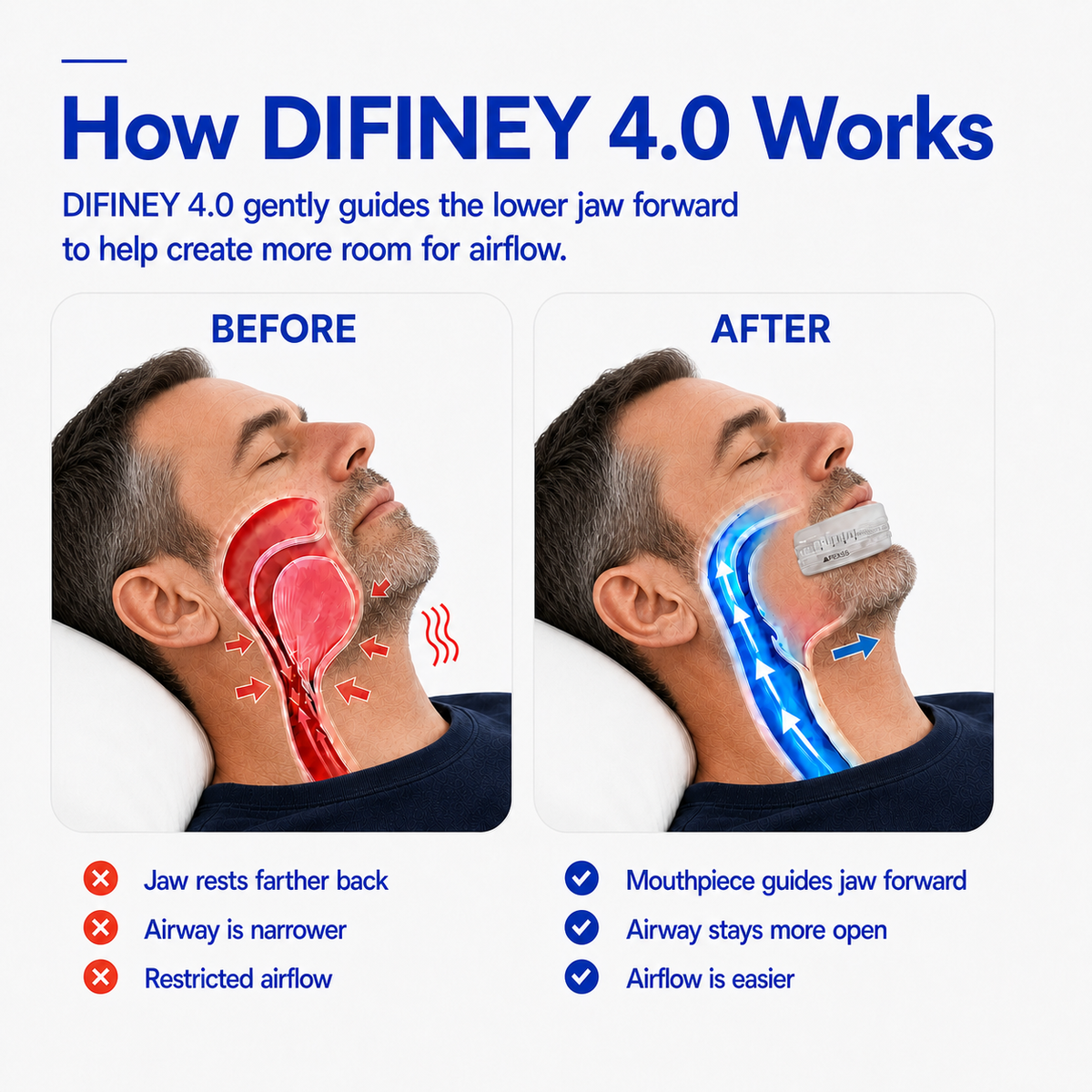 DIFINEY 4.0 airflow and fit mechanism explained