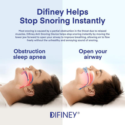 Difiney Anti Snoring Mouthpiece Device: FDA-Cleared - Customizable Adjustable Comfortable