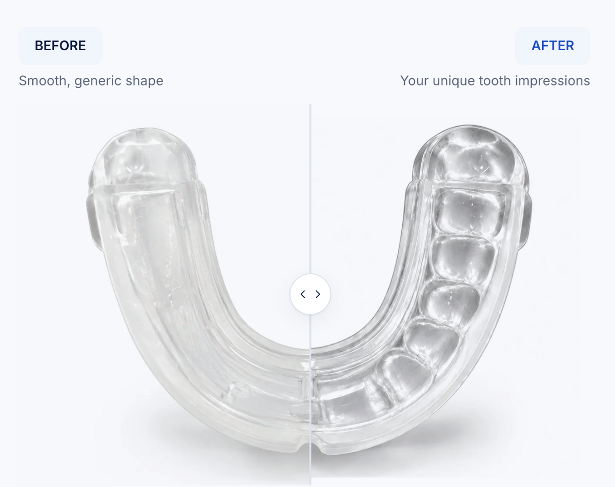 Before and after: a smooth generic tray versus one moulded with your own tooth impressions