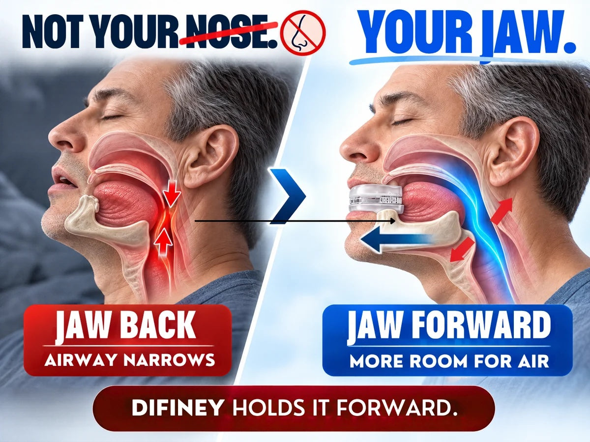 Jaw back narrows the airway; DIFINEY holds the jaw forward for more room for air