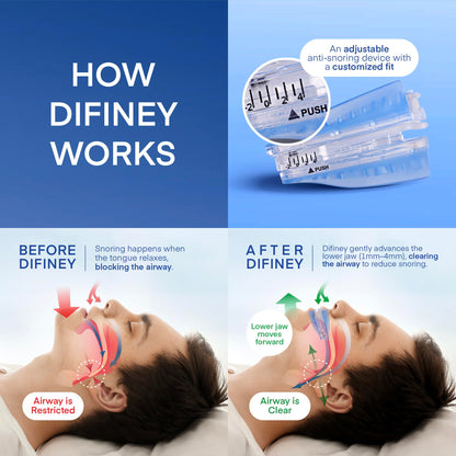 Anti Snoring Device
